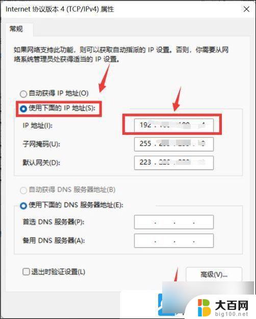 win11如何配置固定ip Win11固定ip地址设置详解